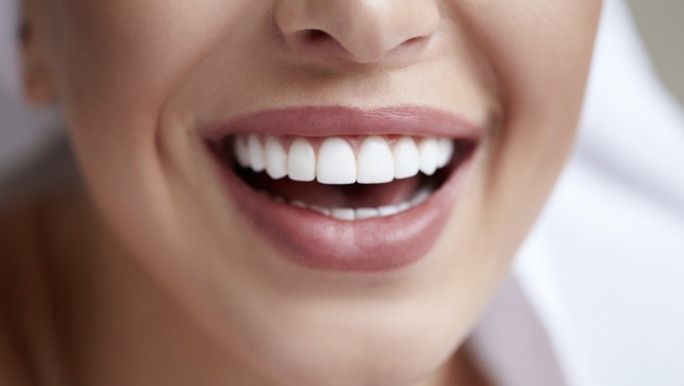 أطعمة بسيطة تعزز بياض الأسنان طبيعيا