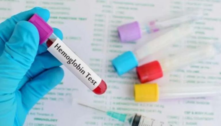 منتصف رمضان ..  5 تحاليل طبية يُنصح بإجرائها لمراقبة الصحة