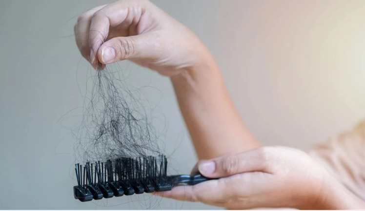 دراسة تكشف كيف يسبب التوتر تساقط الشعر