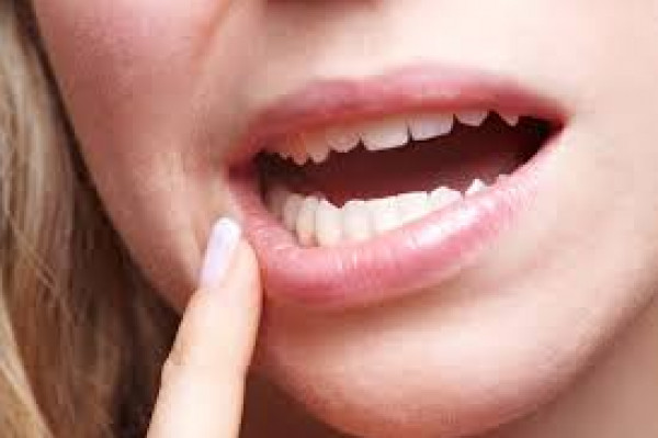 سبب مرض ألزهايمر قد يعيش داخل فمك