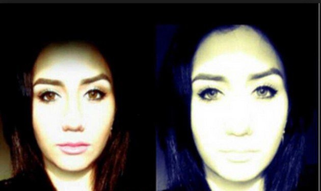 بالصور: هكذا أصبحت نجمة أراب أيدول بعد عملية تجميل فاشلة