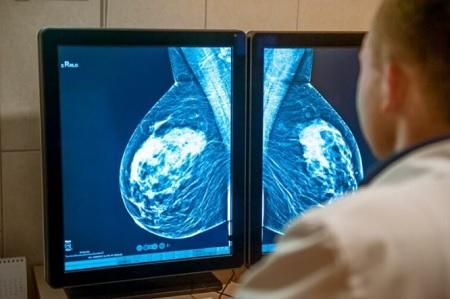 هل يتسبب جهاز الكشف عن سرطان الثدي بالإصابة بالمرض؟