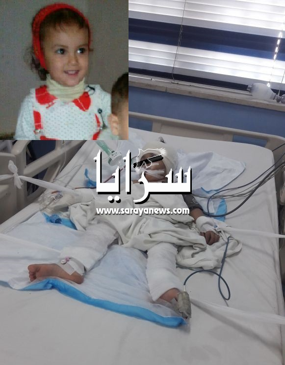 بالصور  ..   الطفلة "منار"  بين الحياة والموت بعد سقوط التلفاز  عليها 