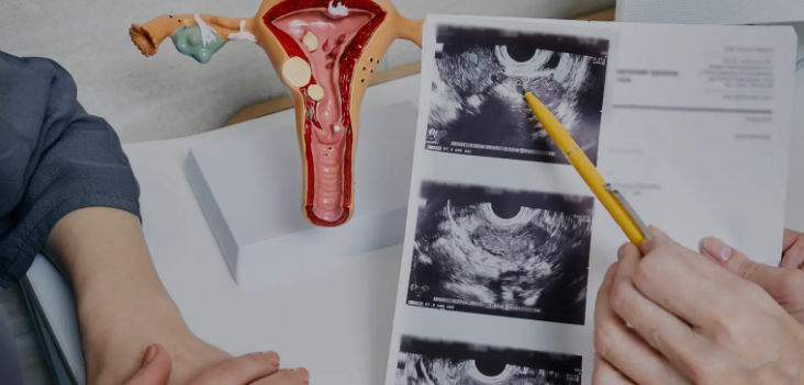 اكتشف أعراض الرحم ذو القرنين وعلاجه وتأثيره على الحمل