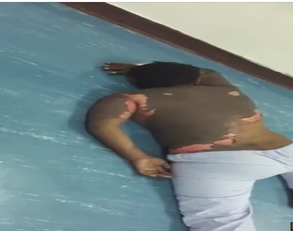 بالفيديو  ..  "مشهد مؤلم" سيدة تحرق زوجها بالزيت المغلي بعد زواجه عليها!