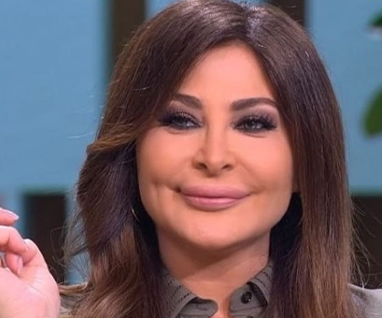 بالصور ..  نجمات لم تلق بهنّ حقن الفيلر