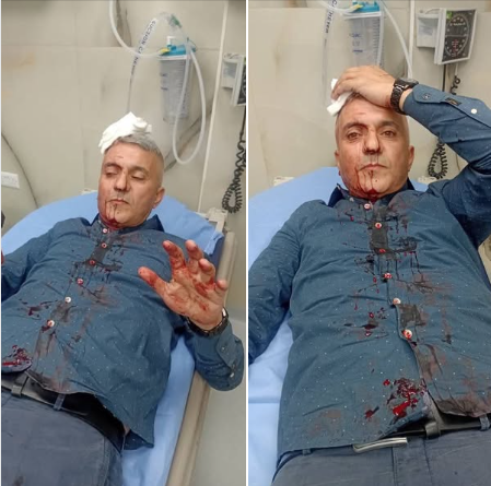 العربية لحقوق الانسان تعرب عن قلقها جراء الاعتداء على الصحفحي فارس الحباشنة 