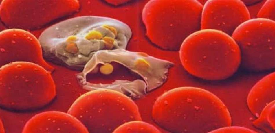 علماء يكشفون فئة الدم التي تحمي من الملاريا