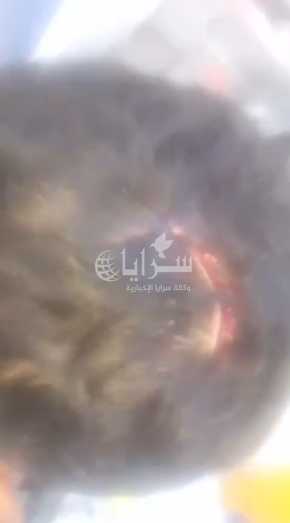 فيديو صادم ..  كلب ضال يمزق رأس طفل في الأشرفية بالكورة وإصابته بجروح بليغة