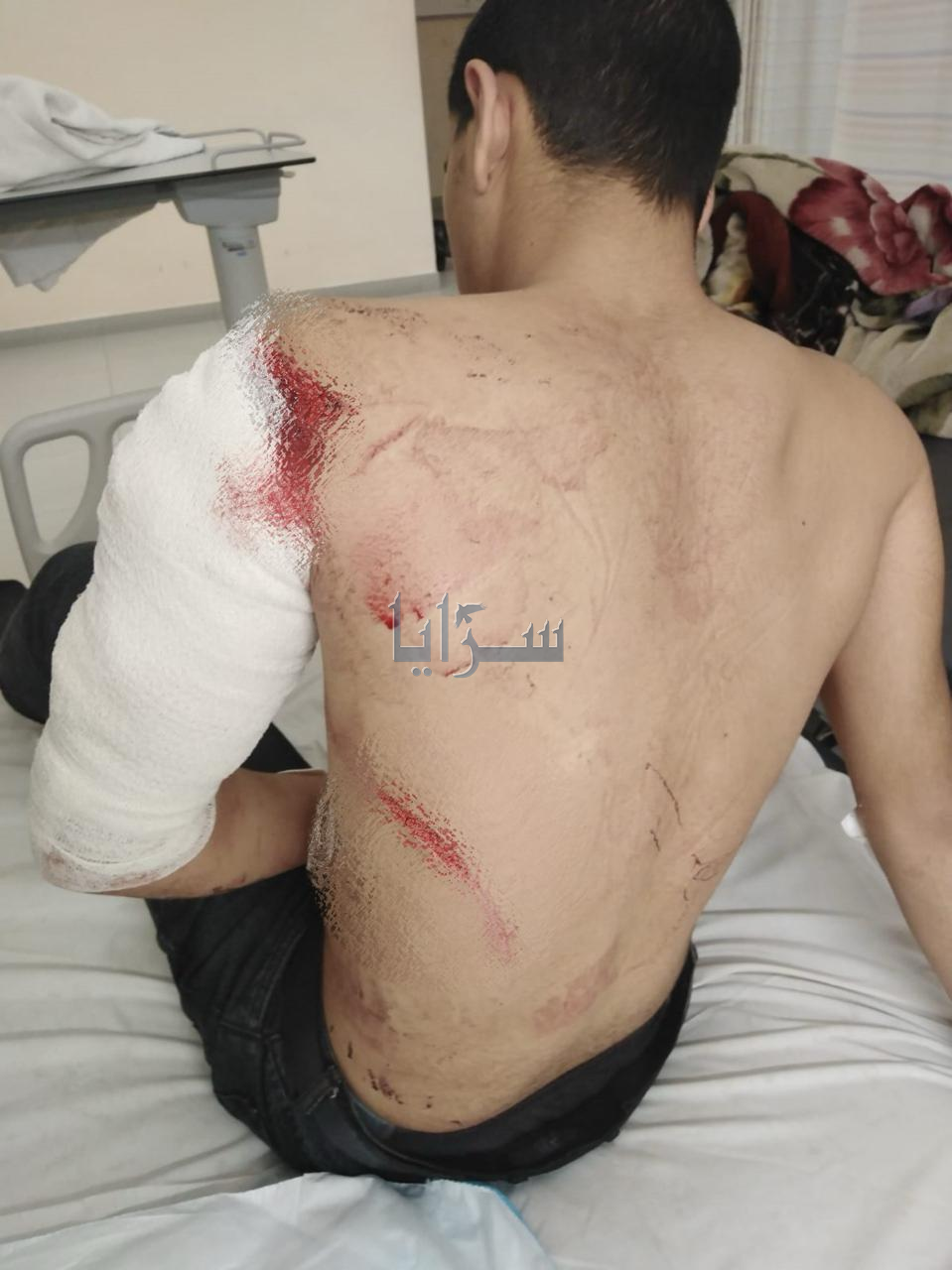 "أصيب بـ 75 غرزة" ..  طعن حدث في منطقة ابو علندا - صور صادمة 