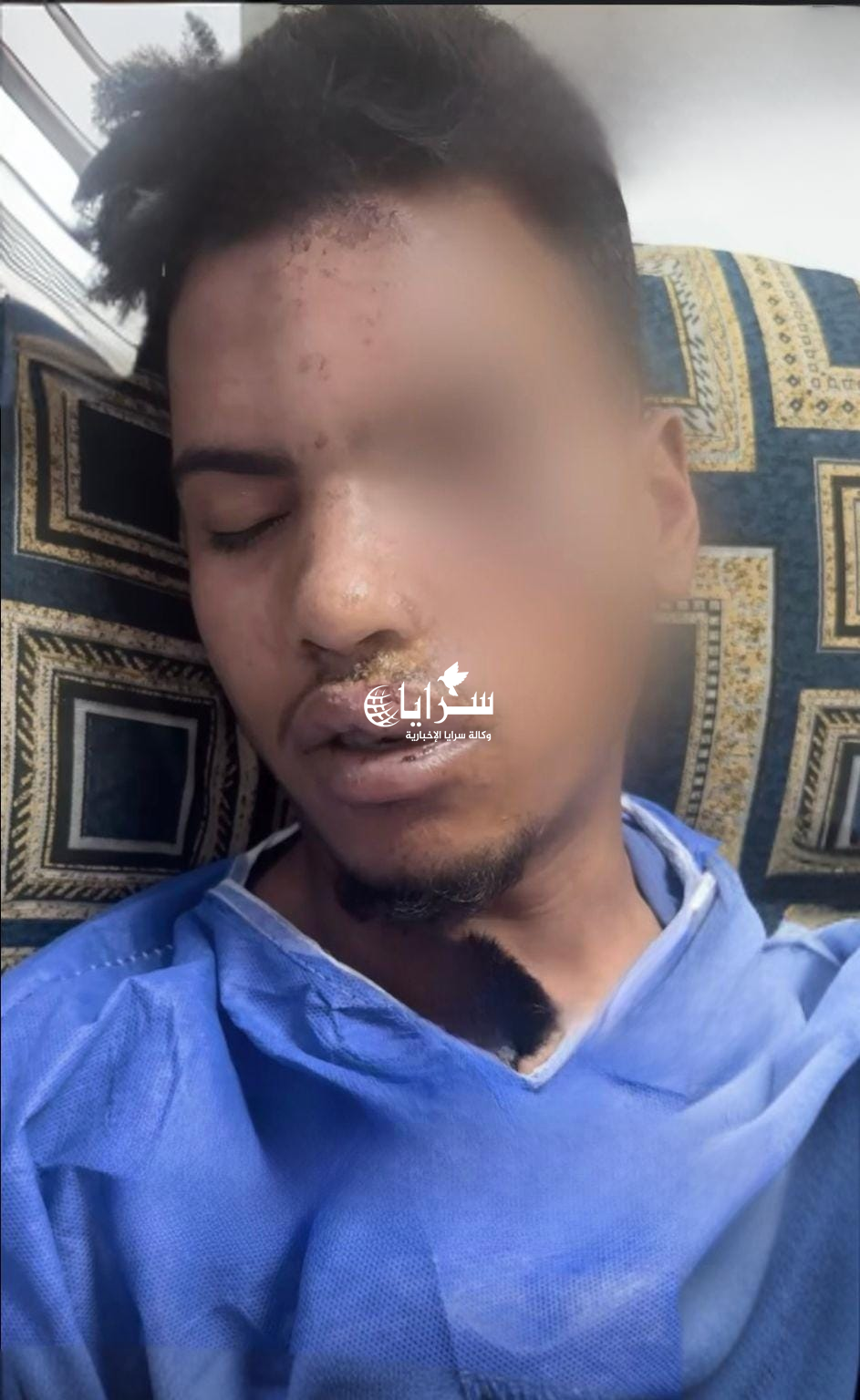 أُجبر على التنازل والمستشفى طرده ..  مأساة عامل وطن تعرض للدهس في الرصيفة