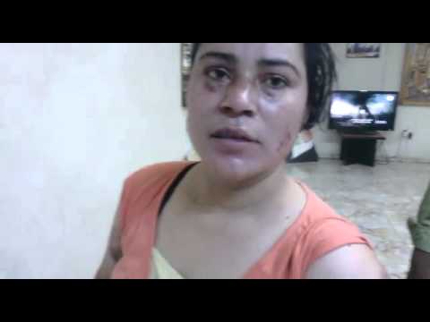 تعذيب خادمة بنغالية في العقبة 