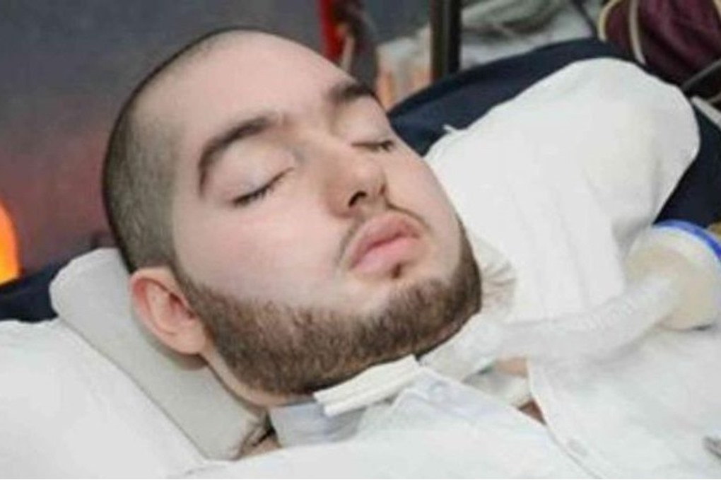 دخل في غيبوبة منذ 21 عاما ..  صور جديدة لـ"الأمير السعودي النائم" - صور