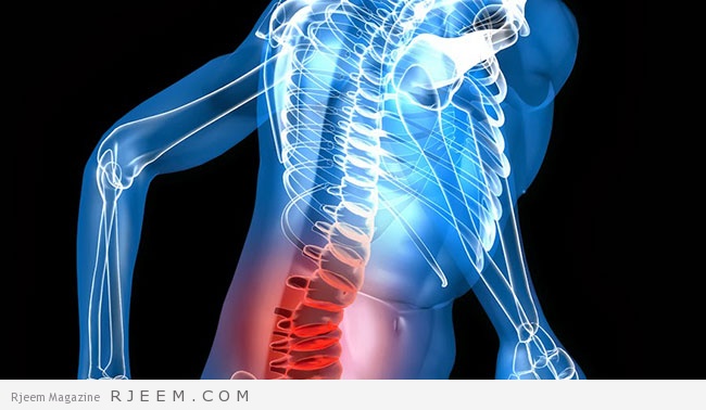 الديسك ..  بين الوقاية والعلاج