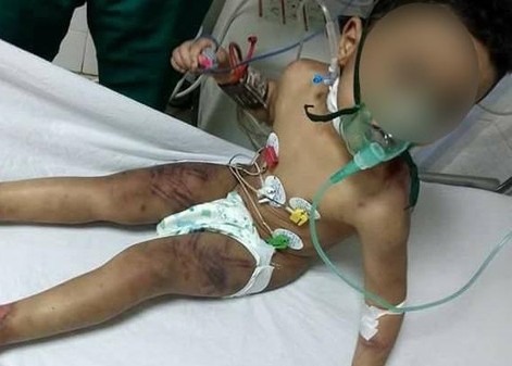 صور صادمة  ..  أم تعذب طفلها بالحرق و الصعق بالكهرباء 