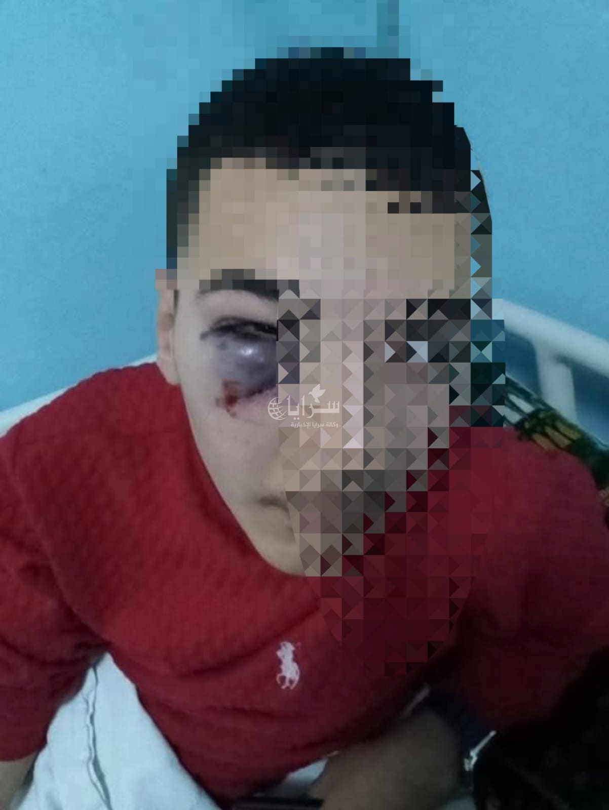 معلم يضرب طالب بـ "كرسي" في عجلون ..  ومدير التربية لـ "سرايا": لا تهاون في قضايا الاعتداء على الطلبة