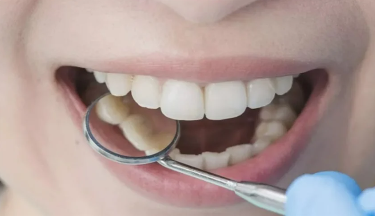 دراسة يابانية صادمة ..  عدد أسنانك قد يتنبأ بموعد رحيلك