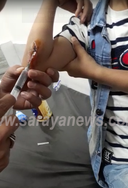 بالفيديو  ..  امام وزير الصحة : ضعف اداء طبيب بمستشفى الامير فيصل يحول دون علاج طفل بعد عجزه عن اكتشاف "حجر" دخل بيده
