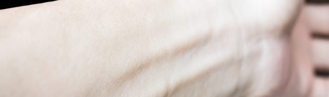 تأثير نقص الحديد على البشرة
