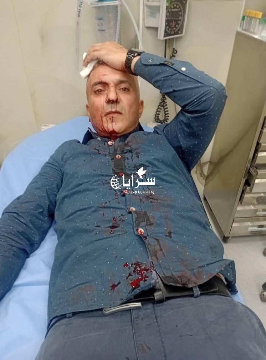 الاعتداء على الزميل فارس الحباشنة أمام منزله في العاصمة عمّان ..  صور