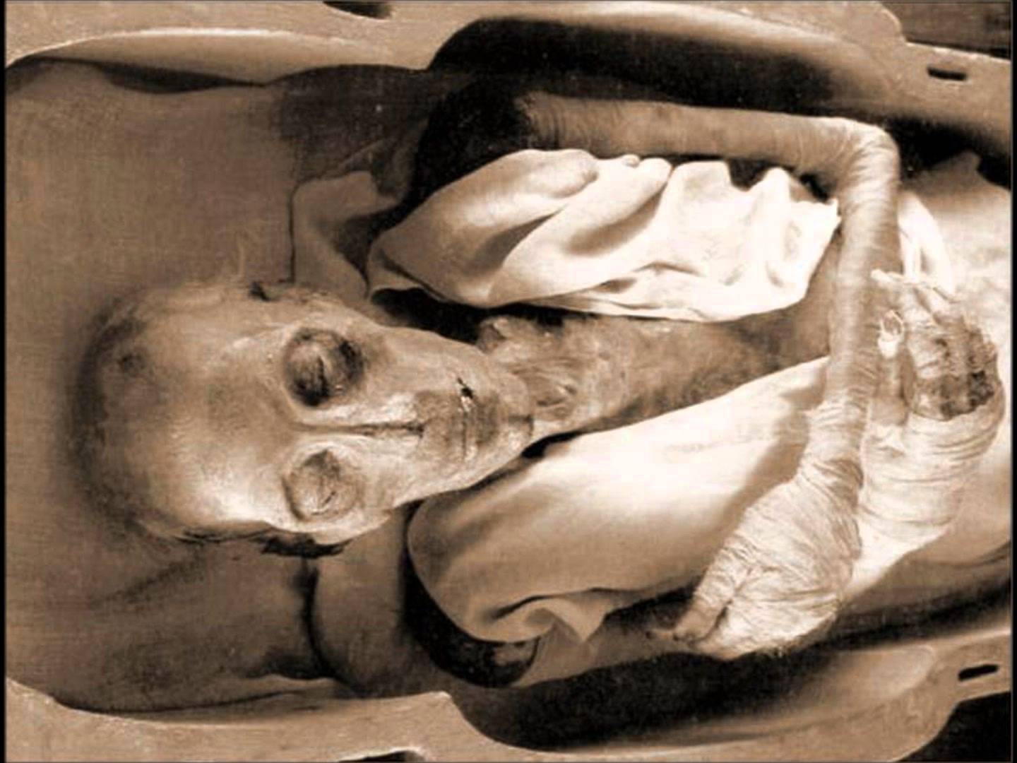 قصة جثة فرعون وإسلام عبقري الجراحة الأول في العالم وأستاذ التشريح العالم الفرنسي (موريس بوكاي)