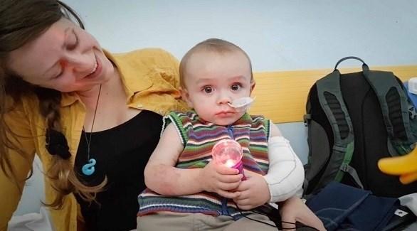 أطباء يبترون ساق طفل اصيب بالانفلونزا 