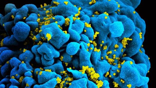 دراسة تكشف عن نهج واعد للقضاء على فيروس نقص المناعة البشرية!