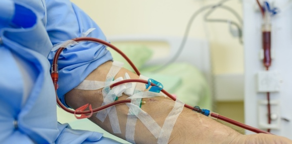 ما هي عملية غسيل الكلى وكيف تتم؟ وهل لها مضاعفات؟ اعرف كل ما يهمك عنها في هذا المقال