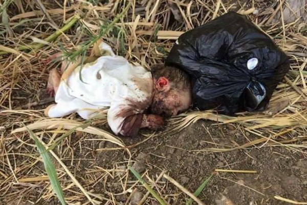 بالصور  ..  ما هو مصير الطفلة  "بتول" التي أكلت الحشرات أطرافها ؟ (تفاصيل) 