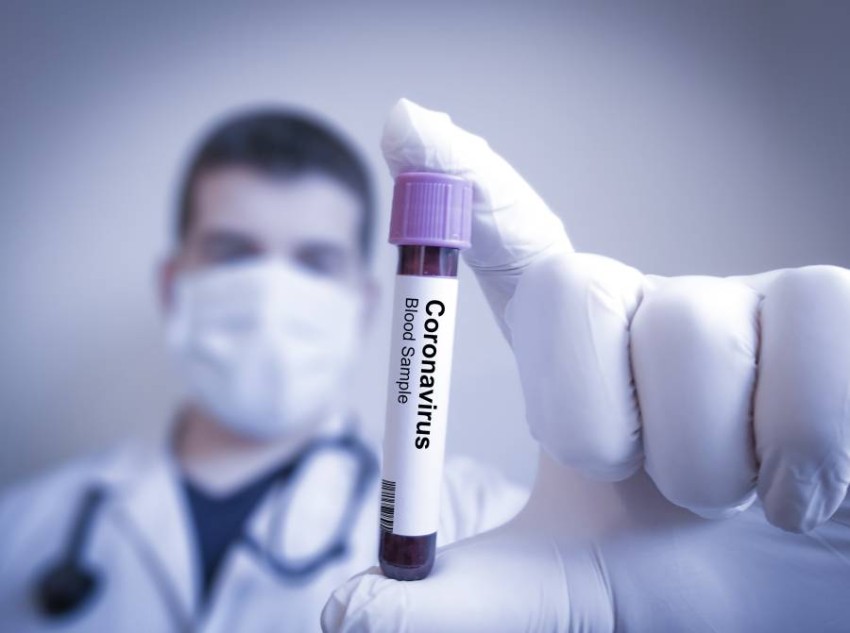 الإمارات تعلن عن تسجيل حالة إصابة جديدة بفيروس "كورونا" لدى وافد صيني
