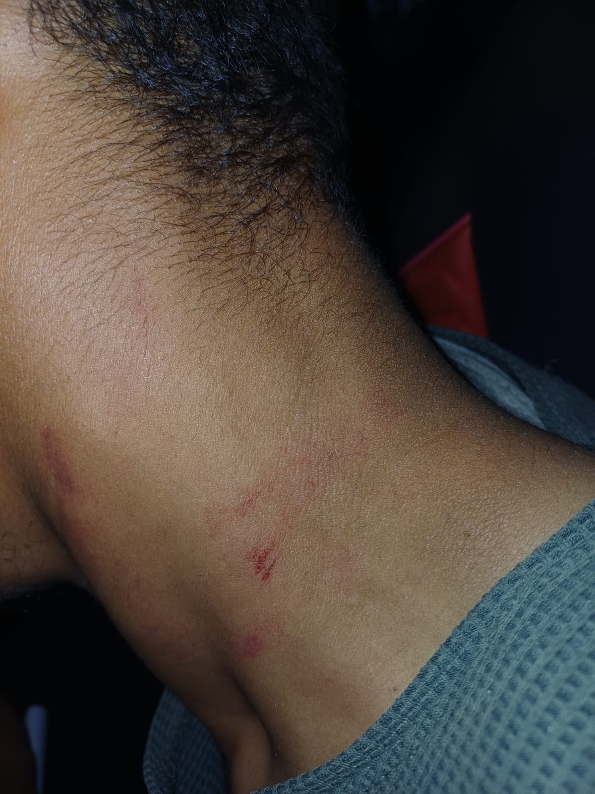 اعتداء على عامل وطن في بلدية اربد أثناء عمله بإزالة النفايات