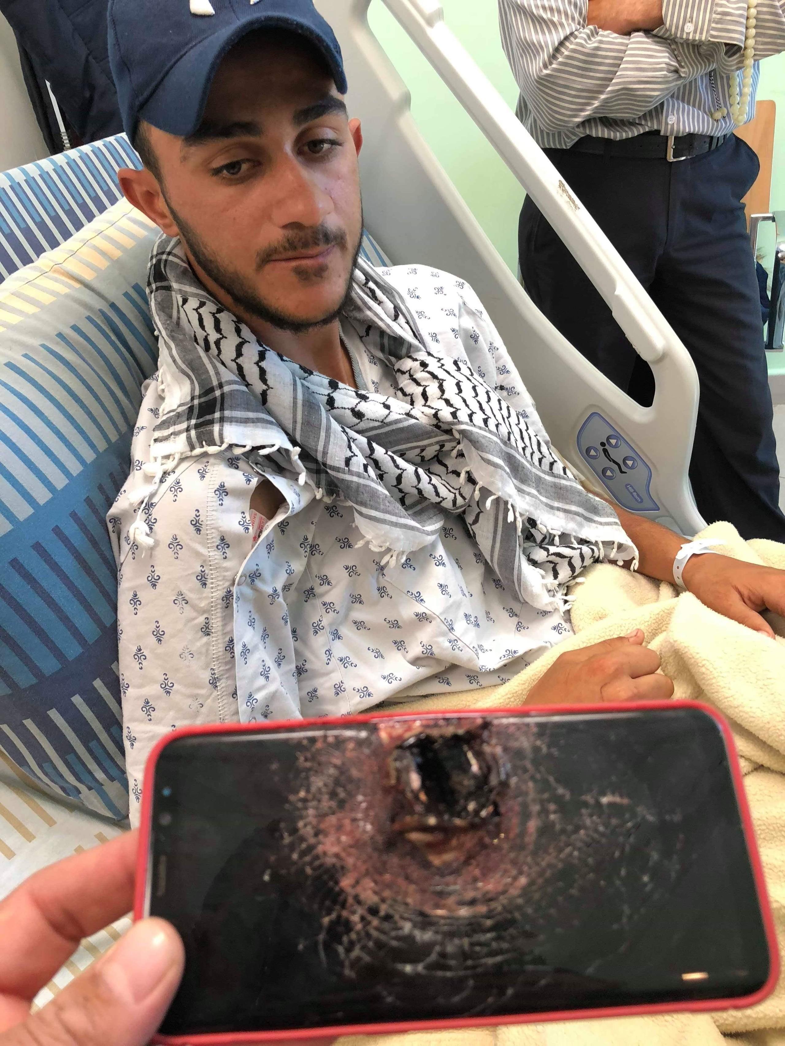 بالصور ..  هاتف ينقذ صحفيا فلسطينيا من رصاصة كادت تخترق شريانه
