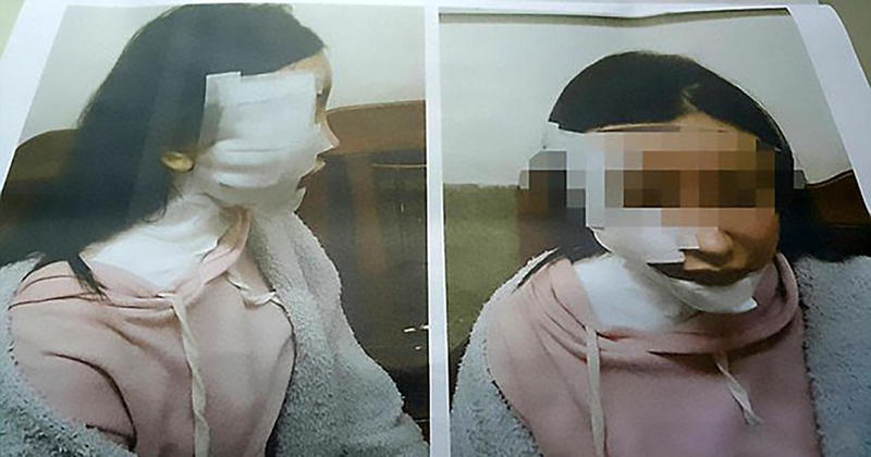 فيديو  صادم  ..  بسبب شعرها  ..  رجل يلقي الحساء المغلي على وجه ثلاثينية فيصيبها بحروق بالغة 