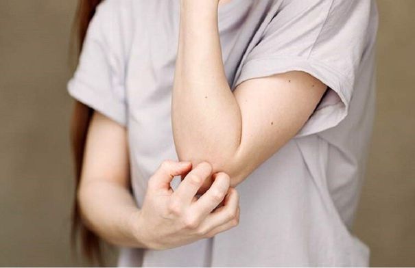 عادات وأمراض مرتبطة بجفاف الجلد