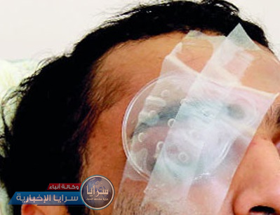 الأغوار الشمالية : صاحب اسبقيات يقتلع عين شاب في بلدة المشارع