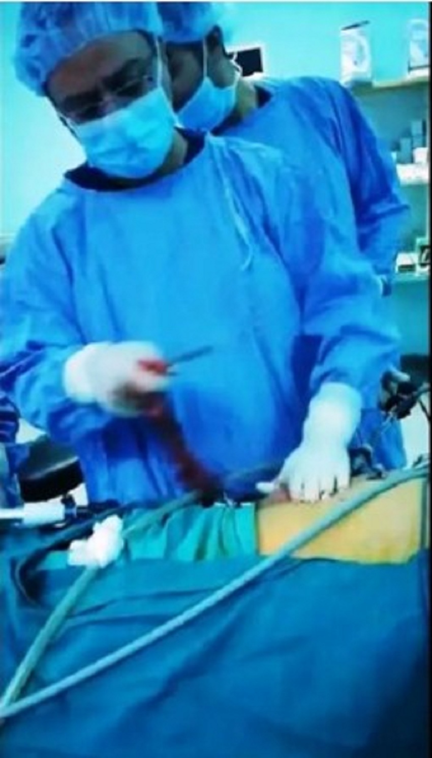 عملية جراحية نوعية  ..  استئصال ورم يزن (3) كيلوغرام من امعاء اربعيني بمستشفى الأميرة بسمة