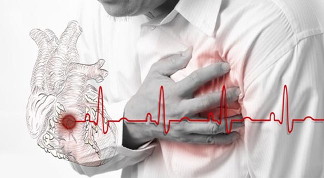 6 أعراض تظهر قبل شهر من النوبة القلبية