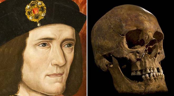الملك ريتشارد الثالث قتل بضربتين في الرأس