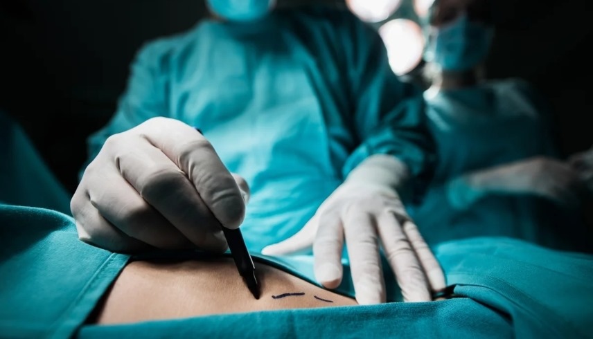 جراحة تتحول إلى فضيحة ..  طبيب يستأصل كبد مريض بدل الطحال "بالخطأ"