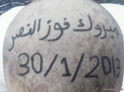 بعد أن خسر الرهان  ..  حلقو رأسه وكتبو عليه 