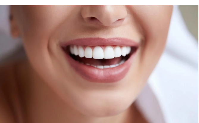 سيصدمك  ..  عادات تدمر الأسنان يجب تجنبها