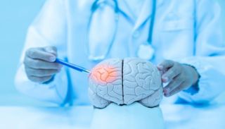 استسقاء الدماغ (Hydrocephalus) ..  ما هي أنواعه وكيفية علاجه؟