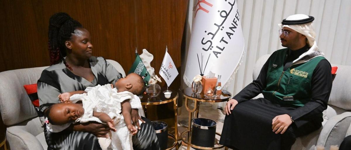 وصول توأم تنزاني ملتصق إلى السعودية تمهيداً لفصلهما