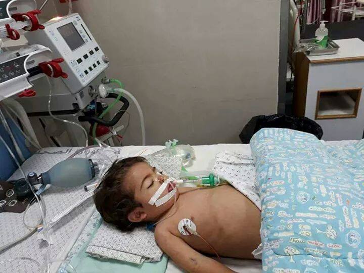 استشهاد الطفل الآغا في غزة بعد رفض تحويله للعلاج بالخارج