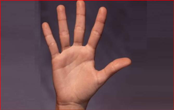 أخيراً ..  العلماء يكتشفون لماذا نملك 5 أصابع وليس 6؟!