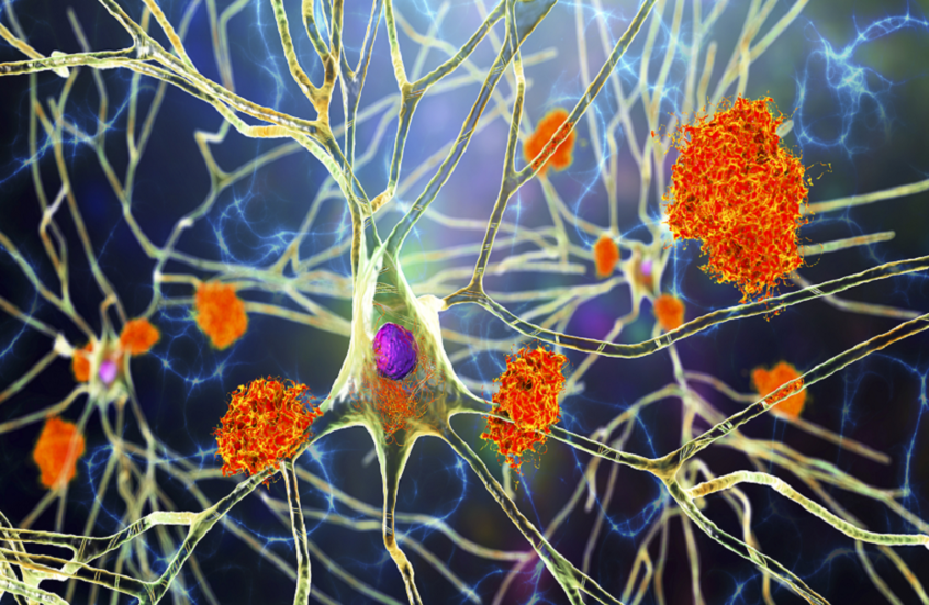 "النبات المعجزة" ..  مفتاح جديد لعلاج ألزهايمر