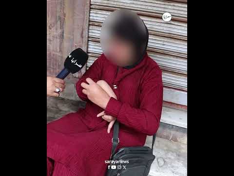 صرخة مليئة بالدموع ..مواطنة تناشد لإنقاذ يدها "المعطوبة" منذ خمس سنوات