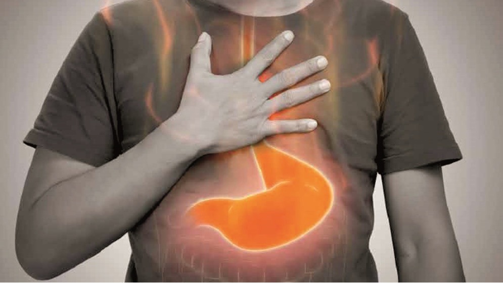 سبب خفي وراء اضطرابات المعدة الشائعة