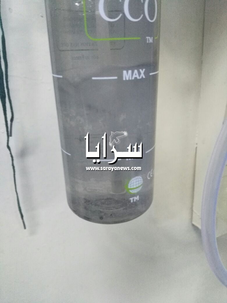 بالفيديو والصور  ..  عجلون : اوساخ وقطع سوداء بجهاز تبخيرة بقسم الطوارئ بمستشفى الايمان 