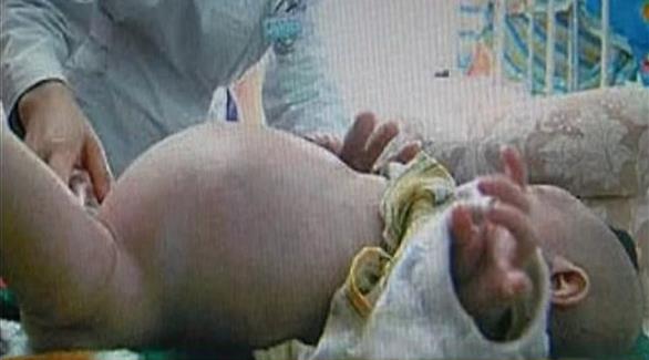 بسبب خطأ في الكمبيوتر: تشخيص طفل صيني يبلغ عاماً بأنه حامل